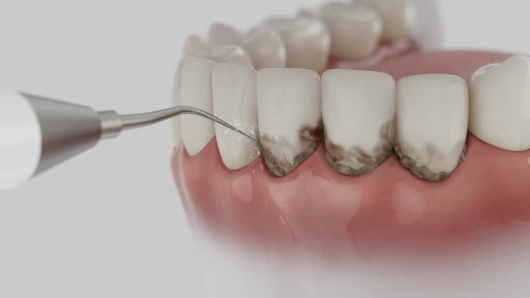 Reliable Dental contractor in Buckeye Lake, OH by Dentist Open Now